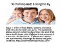 35994_Dental_Implants_Lexington_Ky.