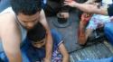 51587_Homs__Wounded_survivors_in_Al_Waer_after_regime_extermination_bombing__Radwan_-01.