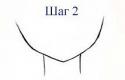 75717_x_a5de34fb.