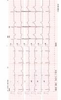 99619_EKG_Katya019.